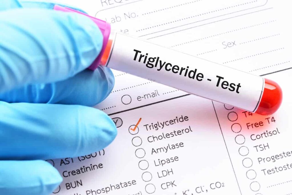 Podwyższone trójglicerydy